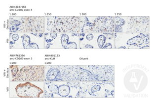 Staining with ABIN318966 at dilutions 1:200, 1:150, 1:200, and 1:250 (two upper rows) using a 7 week elective termination of a missed abortion pregnancy. The upper panels show placental villus and associated decidual tissue, lower panels show staining of villi not associated with decidua. For comparison, tissue samples were stained with ABIN761396, anti-KLH antibody ABIN401183, and diluent alone without any antibody. Images were taken at 400x magnification. VC: placental villus core; T: trophoblast; CT: cytotrophoblast inner layer; ST: syncytiotrophoblast outer layer; DE: decidual epithelium; D: decidua. 