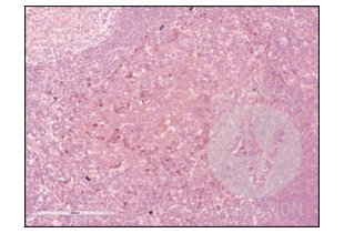 IHC staining of human tonsil with anti-PD-1 antibody ABIN3187786 (1:200) and counterstain with hematoxylin.