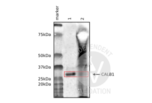 Western Blotting validation image for anti-Calbindin (CALB1) antibody (ABIN3018777)