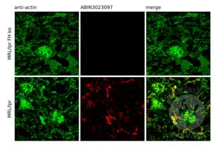 Immunofluorescence validation image for anti-Complement Factor H (CFH) (AA 20-270) antibody (ABIN3023097)