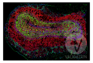 Murine fresh frozen coronal olfactory bulb section (Thickness = 5 µm) labeled with anti-cortactin antibody ABIN2854674 (green; conjugated to fluorophore ATTO 550). Labeling is present in high degrees of labeling in granular and external plexiform layers with additional staining observed in the glomerular neuropil regions. Grin2b and doublecortin were labeled with ABIN5611338 (red; bound to fluorophore ATTO 550) and a doublecortin antibody (blue; bound to fluorophore AF 488).