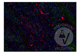 FFPE normal human cortex tissue section labeled with anti-cortactin antibody ABIN2854674 (green; bound to fluorophore ATTO 550) after EDTA antigen retrieval. MAP2 and neurofilament were additionally labeled with anti-MAP2 antibody ABIN125739 (red; bound to fluorophore ATTO 550) and anti-neurofilament antibody (blue; bound to fluorophore AF488).