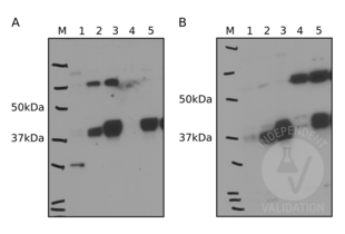 A Western blot detection of ENTPD5 in lysates of untransfected LNCaP (1) and BPH1 (4) cells, doxycline-induced GFP-LNCaP (2), ENTP5-LNCaP (3), and BPH1-ENTPD5 cells (5) using ABIN2856876 (A) or a reference antibody (B). 