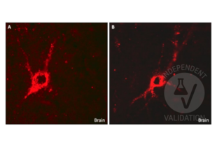 A and B. Detection of GAD1+ neurons in the cortex using ABIN3184725.
