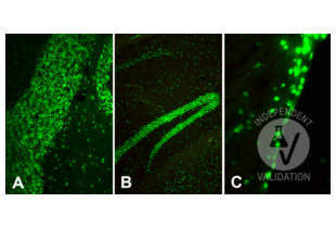 Immunohistochemistry validation image for anti-Histone H4 (3meLys20) antibody (ABIN7260401)