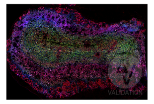 Multiplex Immunohistochemistry validation image for anti-Microtubule-Associated Protein 2 (MAP2) antibody (ABIN125739)