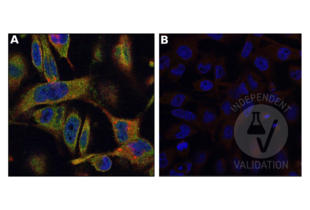 A. IF staining in human cultivated breast cancer cells with anti-MYO1F antibody ABIN6997802 (1:100) and secondary antibody (1:1,000) labeled by green fluorescence and anti-ADAM8 antibody (1:100, product #PA5-47047, Invitrogen, lot #WL3451215) and Donkey anti-Goat IgG (H+L) Secondary Antibody, Texas Red (1:1,000, product #PA1-28662, Invitrogen, lot# VI3078250F) Nuclei stained with Hoechst 33258 (blue). MYO1F staining is observed in in vesicle like structures localized perinuclear and on the inner side of the cell membrane. Magnification 63x. B. Negative control without primary antibody.