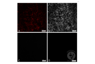 CX3CL1 positive cells in CX3CL1mcherry murine thymus (A, mCherry) were stained with ABIN1043867 and an AF647 conjugated secondary antibody (B) or with the secondary antibody alone (C). CX3CL1 positive cells in CX3CL1 wt murine thymus were stained with ABIN1043867 and the AF647 conjugated antibody (D). Scale bar 100?m, 20x magnification, 1000 resolution 