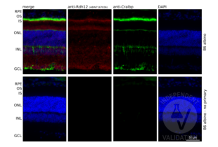 Retinal sections from the wild-type (B6 albino) mice immunostained with anti-RDH12 antibody ABIN7167836. DAPI staining shows localization of the inner (INL) and outer (ONL) nuclear layer of the mouse retina. Cralbp (Rlbp1) co-staining was used to visualize RPE and Müller glia cells in the retina. Presence of specific signal in the RPE cell layer confirms specific immunoreactivity. 