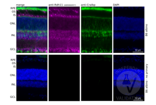 Immunohistochemistry validation image for anti-Retinol Dehydrogenase 11 (All-Trans/9-Cis/11-Cis) (RDH11) antibody (ABIN966957)