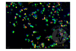 Multiplex Immunohistochemistry validation image for anti-SARS-CoV-2 Spike S1 (AA 318-510), (RBD) antibody (ABIN6952546) (Recombinant SARS-CoV-2 Spike S1 anticorps  (RBD))