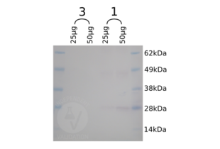 Western blot analysis of CBD-SNAP tag expression in 25µg and 50µg total protein respectively of bacterial lysates from two different colonies (1 and 3). In colony 1 of approximately 25kDa, the expected size for CBD-SNAP, is revealed where as no band is visible in the negative control culture grown from colony 3.
