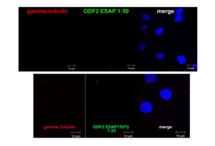 Anti-ODF2 antibody ABIN2430582 (ESAP15572) is detected with a MFP488 goat anti-rabbit IgG (H+L) secondary antibody (green). The control mouse anti-γ-tubulin antibody is detected with a MFP590 goat anti-mouse secondary antibody (red). DNA is counterstained with DAPI (blue).