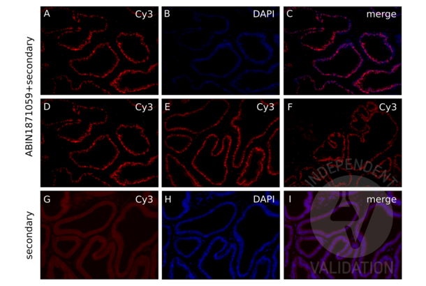 Androgen Receptor anticorps