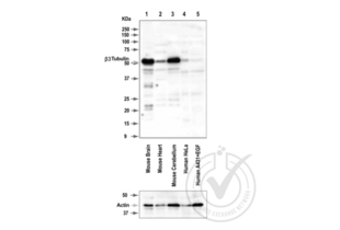 Figure 1: Western Blot for Tubulin, Beta, 3 (TUBB3). Grey arrowhead indicates the expected molecular weight of ~50 kDa.