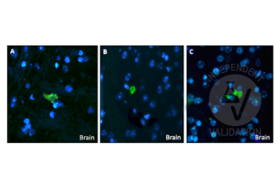 Staining of beta-amyloid positive cells in the adult mouse brain using ABIN95037 at 40x magnification. 