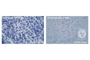 Positive control with Alkaline Phosphatase Anti-Digoxigenin antibody on P5 CD1 mouse brain. Images show reaction with and without DNase treatment to increase cellular death. Magnification: 40x.