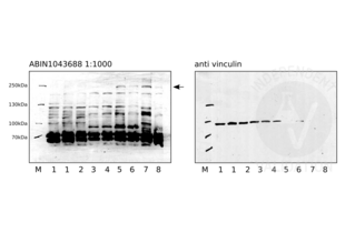 Western Blotting validation image for anti-Notch 2 (NOTCH2) antibody (ABIN1043688)