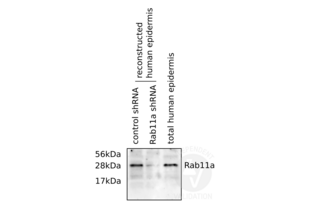 Western blot analysis of reconstructed human epidermis cell lysates with ABIN2346690 reveals a band of the expected size for Rab11a in the lysates of the cells transfected with a scrambled control shRNA (left lane) which is absent in lysates from cells that were transfected with RAB11A shRNA. Total human epidermis lysates (right lane) served as control. The immunoblot with ABIN2346690 reveals the expected protein band. 
