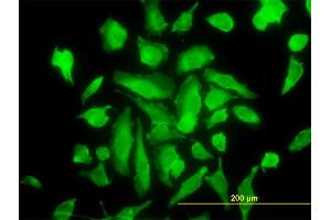 Immunofluorescence of monoclonal antibody to PRKCA on HeLa cell.