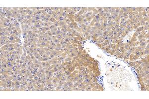 Detection of LCAT in Mouse Liver Tissue using Polyclonal Antibody to Lecithin Cholesterol Acyltransferase (LCAT) (LCAT anticorps  (AA 41-210))