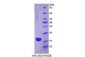 SDS-PAGE of Protein Standard from the Kit  (Highly purified E.