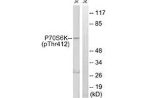 Western blot analysis of extracts from Jurkat cells treated with Insulin 0. (RPS6KB1 anticorps  (pThr412))