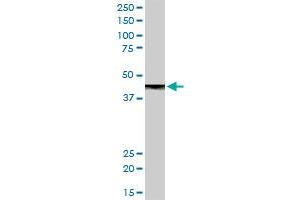 CPB1 MaxPab rabbit polyclonal antibody. (CPB1 anticorps  (AA 1-417))