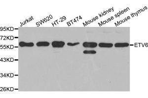 Western blot analysis of extracts of various cell lines, using ETV6 antibody. (ETV6 anticorps  (AA 1-300))