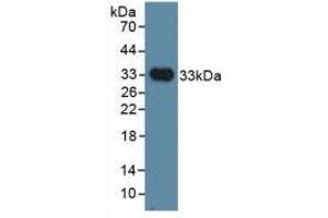 Western blot analysis of recombinant Human INHBP. (IGSF1 anticorps  (AA 1008-1227))