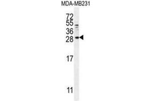 BTC Antibody (N-term) western blot analysis in MDA-MB231 cell line lysates (35µg/lane). (Betacellulin anticorps  (N-Term))