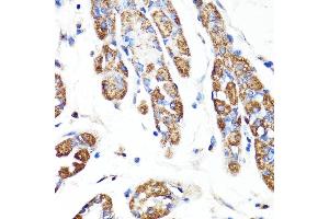 Immunohistochemistry of paraffin-embedded human stomach using RNF149 antibody (ABIN7270062) at dilution of 1:100 (40x lens). (RNF149 anticorps  (AA 221-400))