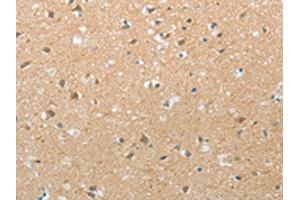 The image on the left is immunohistochemistry of paraffin-embedded Human brain tissue using ABIN7192728(TACR2 Antibody) at dilution 1/20, on the right is treated with synthetic peptide. (TACR2 anticorps)