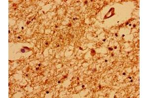 Immunohistochemistry of paraffin-embedded human brain tissue using ABIN7172228 at dilution of 1:100 (TRNP1 anticorps  (AA 10-180))