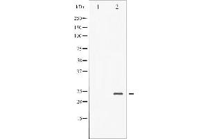 Western blot analysis of BAD phosphorylation expression in Forskolin treated NIH-3T3 whole cell lysates,The lane on the left is treated with the antigen-specific peptide.
