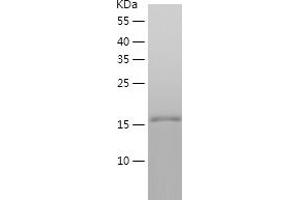 Western Blotting (WB) image for Tumor Necrosis Factor (Ligand) Superfamily, Member 9 (TNFSF9) (AA 71-254) protein (His-IF2DI Tag) (ABIN7125533)