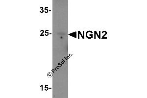 Western Blotting (WB) image for anti-Neurogenin 2 (NEUROG2) (C-Term) antibody (ABIN1077397) (Neurogenin 2 anticorps  (C-Term))