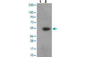 Western blot analysis of Lane 1: antigen-specific peptide treated 3T3 cells, Lane 2: 3T3 cells with CAMK2A/CAMK2B/CAMK2D (phospho T305) polyclonal antibody  at 1:500-1:1000 dilution.