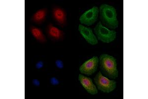 ABIN6255339 and ABIN6267494 staining Hela cells(4h of LPS treatment) by IF/ICC.