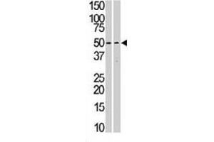 The STK38L polyclonal antibody  is used in Western blot to detect STK38L in Jurkat (left) and T-47D (right) cell line lysates. (STK38L anticorps  (C-Term))