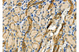 ABIN6266034 and ABIN6277649 at 1/100 staining Rat kidney tissue by IHC-P.