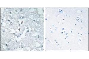 Immunohistochemistry analysis of paraffin-embedded human brain tissue, using GLCTK Antibody. (GLYCTK anticorps  (AA 101-150))