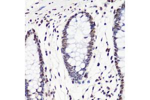 Immunohistochemistry of paraffin-embedded human colon using H3K36me2 antibody.