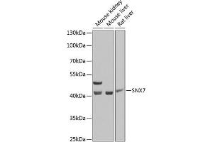 Western blot analysis of extracts of various cell lines, using SNX7 Antibody (ABIN6128732, ABIN6148257, ABIN6148258 and ABIN6223768) at 1:1000 dilution.