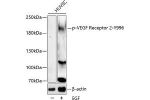 Western blot analysis of extracts of HUVEC cell line, using Phospho-VEGF Receptor 2-Y996 antibody (ABIN6135337, ABIN6136290, ABIN6136291 and ABIN6225613). (VEGFR2/CD309 anticorps  (pTyr996))