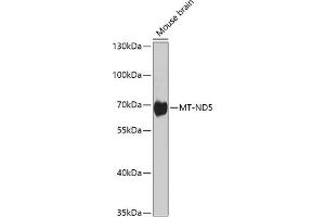 Western blot analysis of extracts of various cell lines, using MT-ND5 antibody (ABIN6135116, ABIN6144435, ABIN6144437 and ABIN6224158) at 1:1000 dilution. (MT-ND5 anticorps  (AA 500-600))