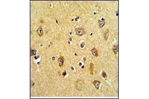 AP18157PU-N PPP2R2B Antibody staining of Formalin-fixed and paraffin-embedded human brain tissue using peroxidase-conjugated secondary antibody, followed by DAB staining.