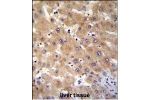 GAGE12B Antibody (N-term) (ABIN655201 and ABIN2844816) immunohistochemistry analysis in formalin fixed and paraffin embedded human liver tissue followed by peroxidase conjugation of the secondary antibody and DAB staining. (G Antigen 12B anticorps  (N-Term))