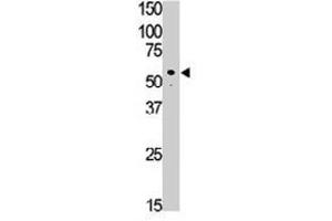 The SIGLEC7 polyclonal antibody  is used in Western blot to detect SIGLEC7 in Jurkat cell lysate. (SIGLEC7 anticorps  (C-Term))