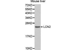 Western Blotting (WB) image for anti-Lipocalin 2 (LCN2) (AA 1-100) antibody (ABIN3017526) (Lipocalin 2 anticorps  (AA 1-100))